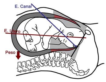 2._Dolor_y_epidural.Tendida_copiar
